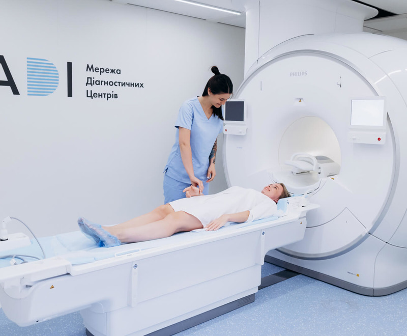 Кубітальний тунельний синдром